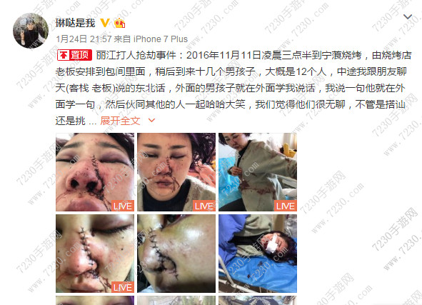 丽江旅游被打毁容是怎么回事 丽江打人抢劫事件