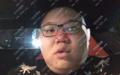 主播PDD我是靠脸吃饭的不能留疤 医生 啊?