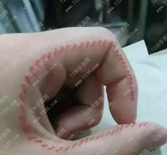 人体刺绣是自残吗 人体刺绣疼吗